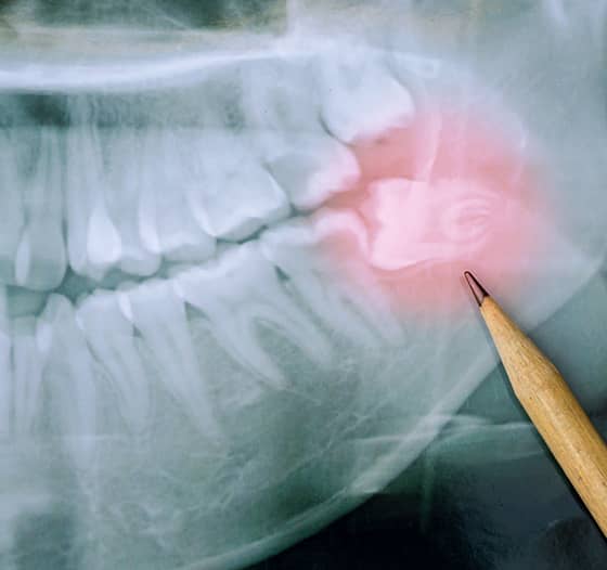 Treatment - SmileMaker Dental Care