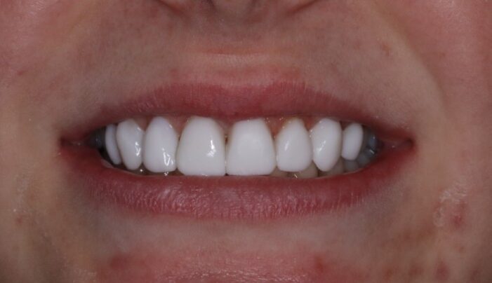 After - Smilemakerdentalcare