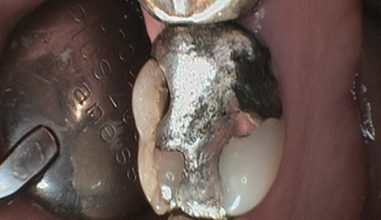 Before - Smilemakerdentalcare