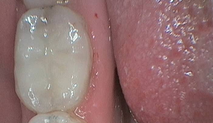 After - Smilemakerdentalcare