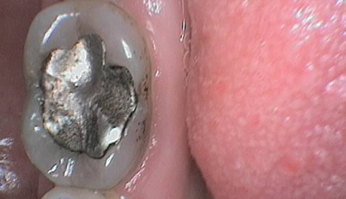 Before - Smilemakerdentalcare