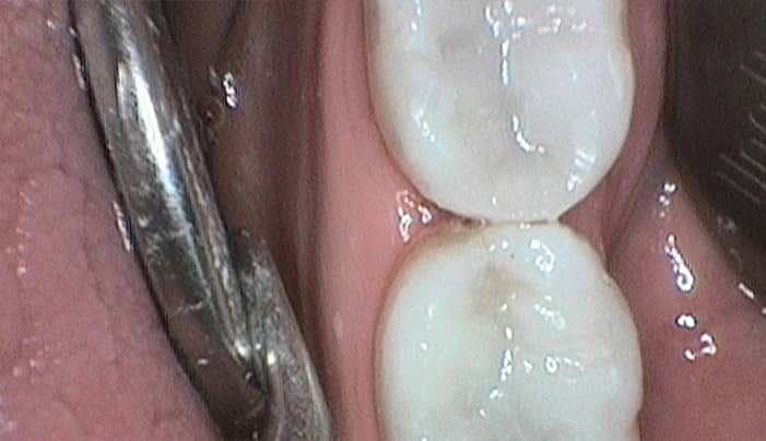 After - Smilemakerdentalcare