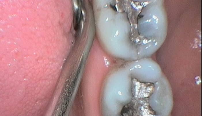 Before - Smilemakerdentalcare