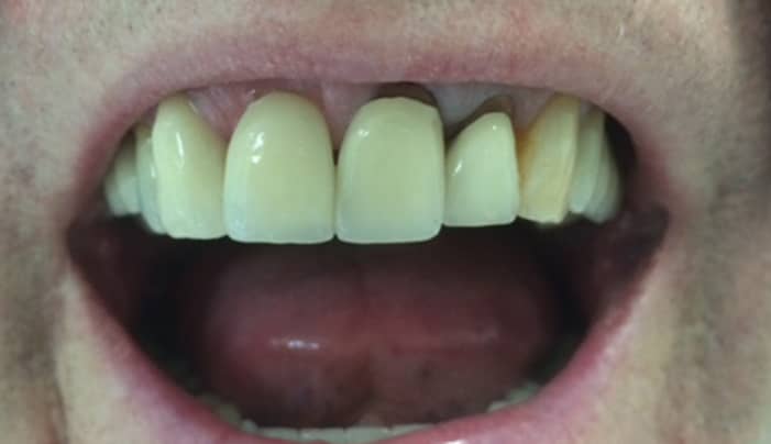 Before - Smilemakerdentalcare