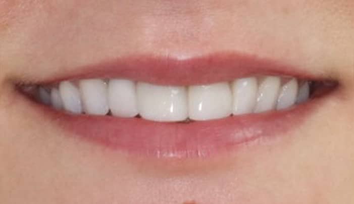 After - Smilemakerdentalcare
