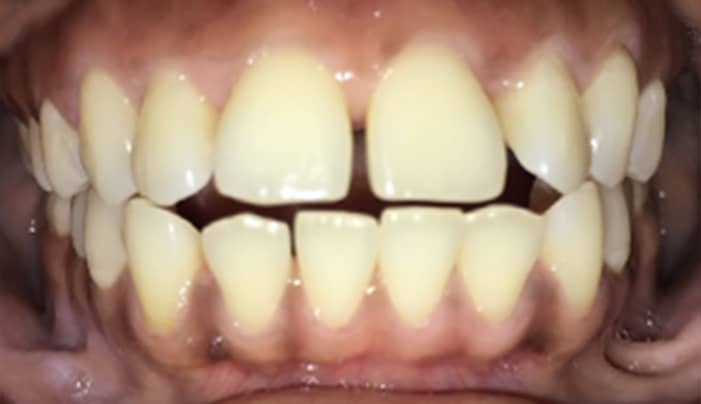 Before - Smilemakerdentalcare