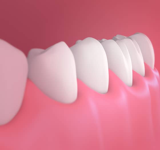 Treatment - SmileMaker Dental Care