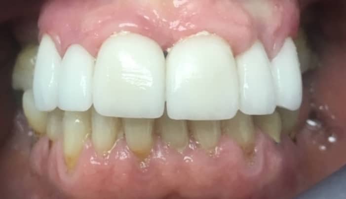 After - Smilemakerdentalcare