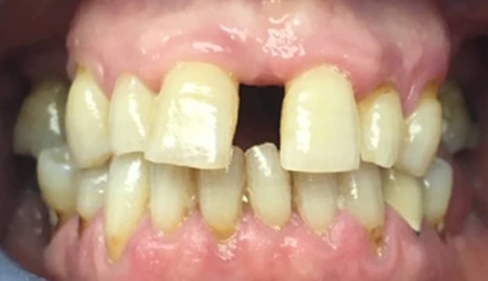 Before - Smilemakerdentalcare