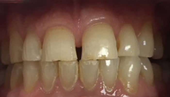 Before - Smilemakerdentalcare