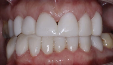 After - Smilemakerdentalcare